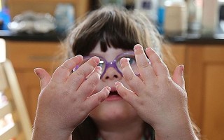 Как диагностировать и лечить ювенильный ревматоидный артрит